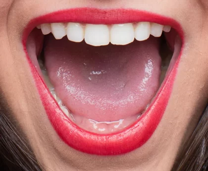 Most Common Oral Infections (Part 2)