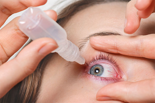 Treatments of Eye Infection