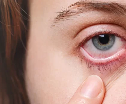 Eye Infection: Symptoms, Causes & Treatment