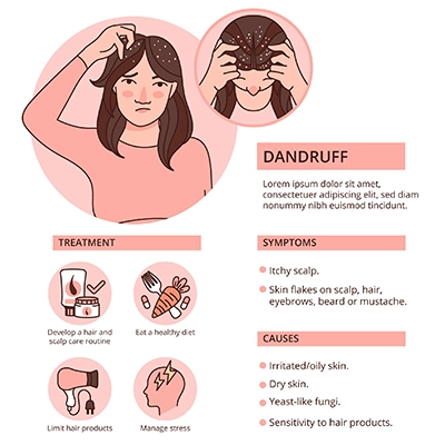 Dandruff: Types, Symptoms, Causes, & Prevention