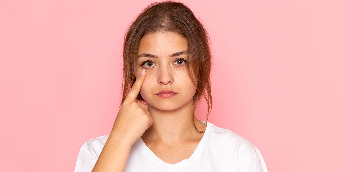 Dark Circles Under Eyes: Symptoms, Remedies & Prevention