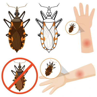 Chagas Disease: Types, Symptoms, Causes & Prevention